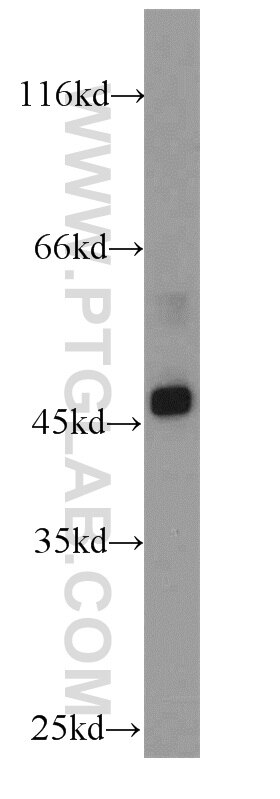 Western Blot (WB) analysis of HepG2 cells using SUV39H1 Polyclonal antibody (10574-1-AP)