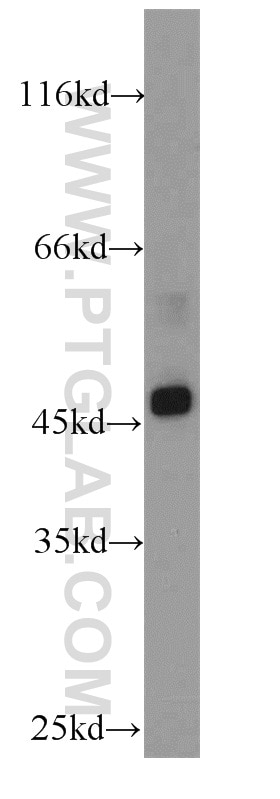 Western Blot (WB) analysis of HepG2 cells using SUV39H1 Polyclonal antibody (10574-1-AP)