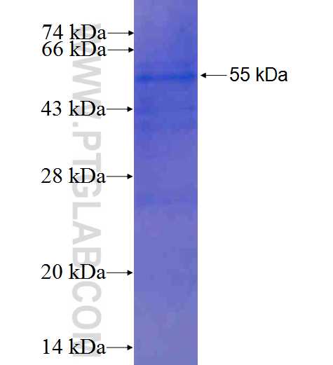 SUV39H1 fusion protein Ag0854 SDS-PAGE