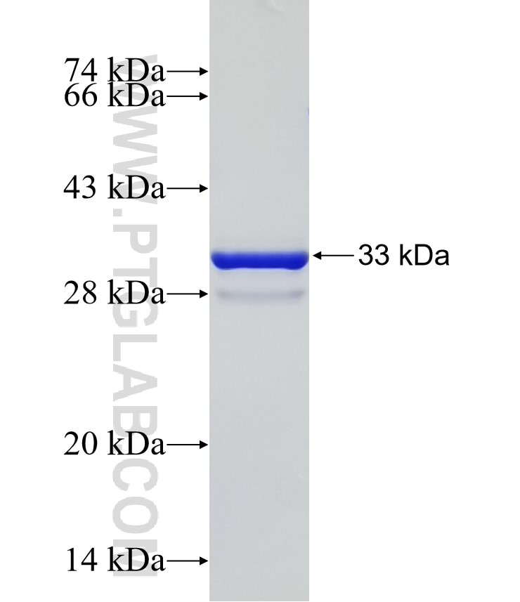 SUV39H2 fusion protein Ag31589 SDS-PAGE SUV39H2 fusion protein Ag31589 SDS-PAGE
