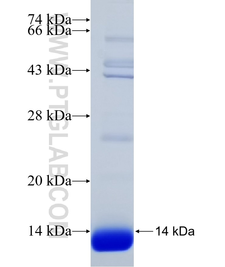 SUV39H2 fusion protein Ag31601 SDS-PAGE SUV39H2 fusion protein Ag31601 SDS-PAGE