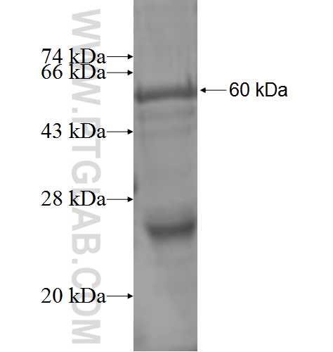 SUV39H2 fusion protein Ag1882 SDS-PAGE