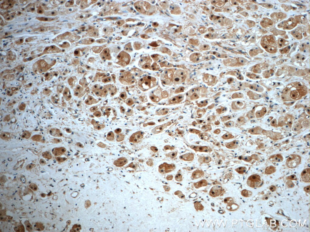 SUZ12 Polyclonal antibody