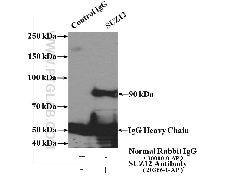 Immunoprecipitation (IP) experiment of HeLa cells using SUZ12 Polyclonal antibody (20366-1-AP)