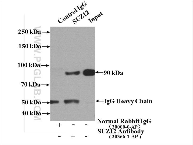 IP experiment of HeLa using 20366-1-AP