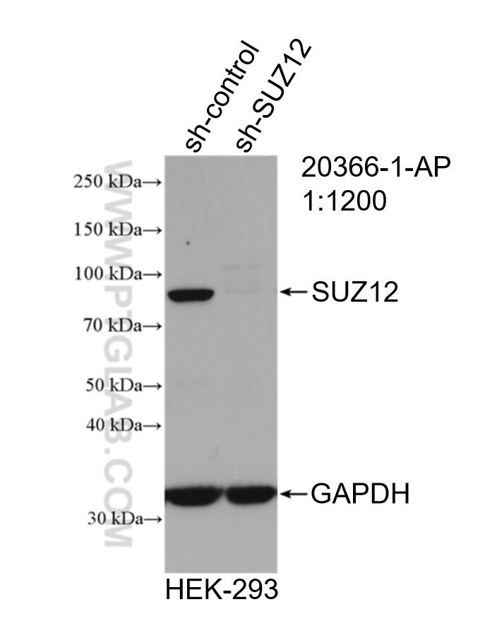 Western Blot (WB) analysis of HEK-293 cells using SUZ12 Polyclonal antibody (20366-1-AP)