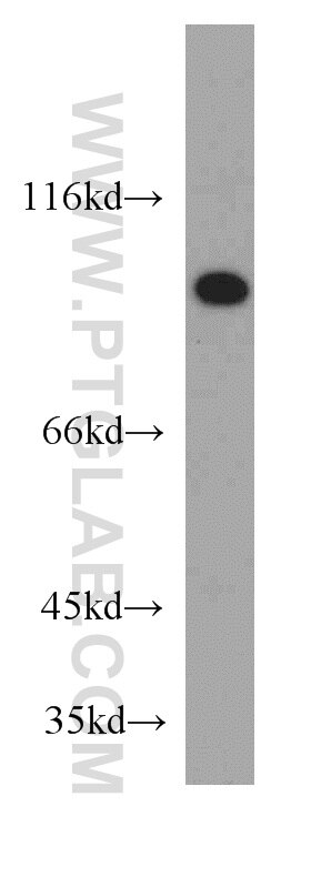 SUZ12 Polyclonal antibody