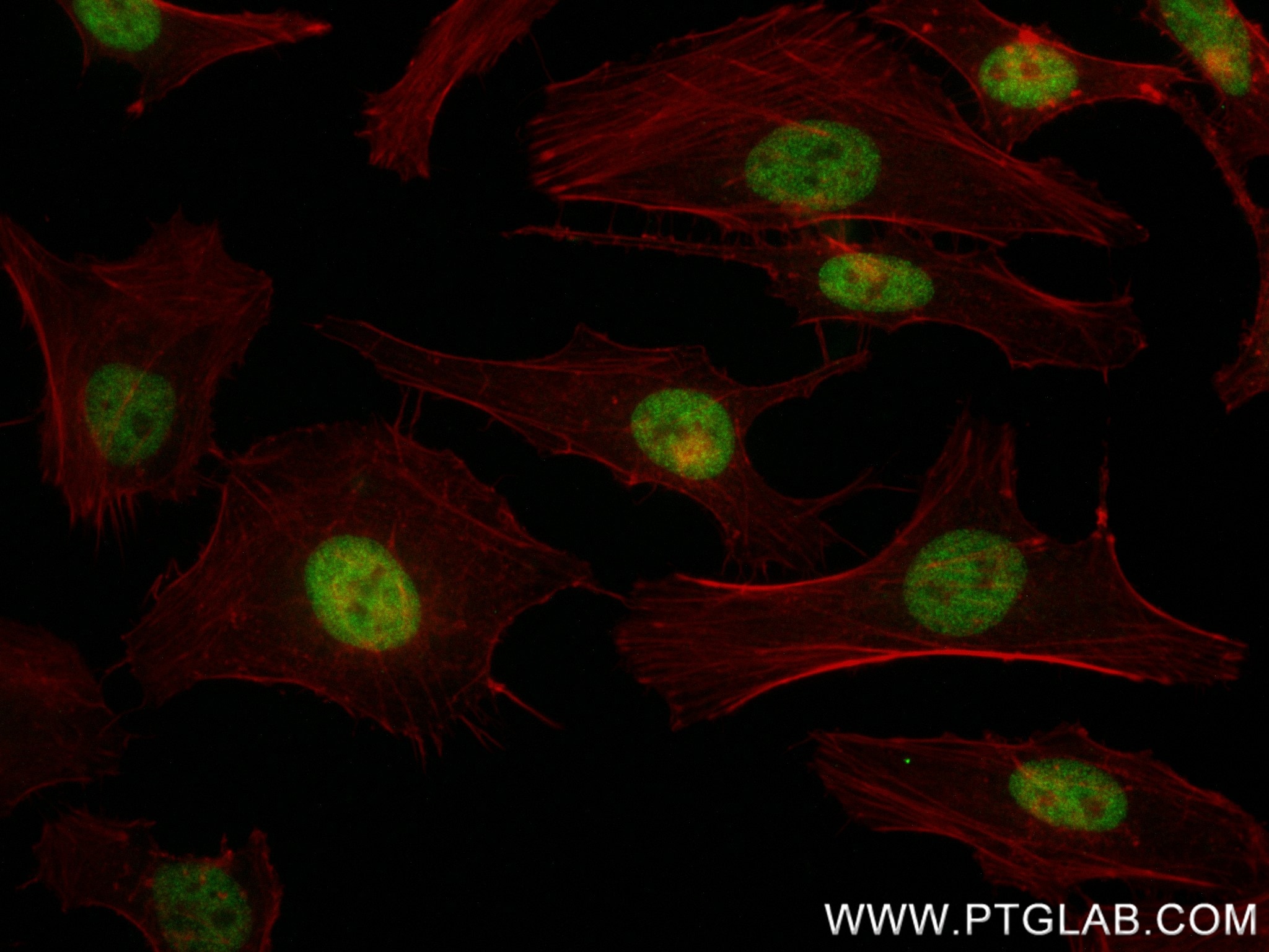 Immunofluorescence (IF) / fluorescent staining of HeLa cells using SUZ12 Recombinant antibody (84895-3-RR)