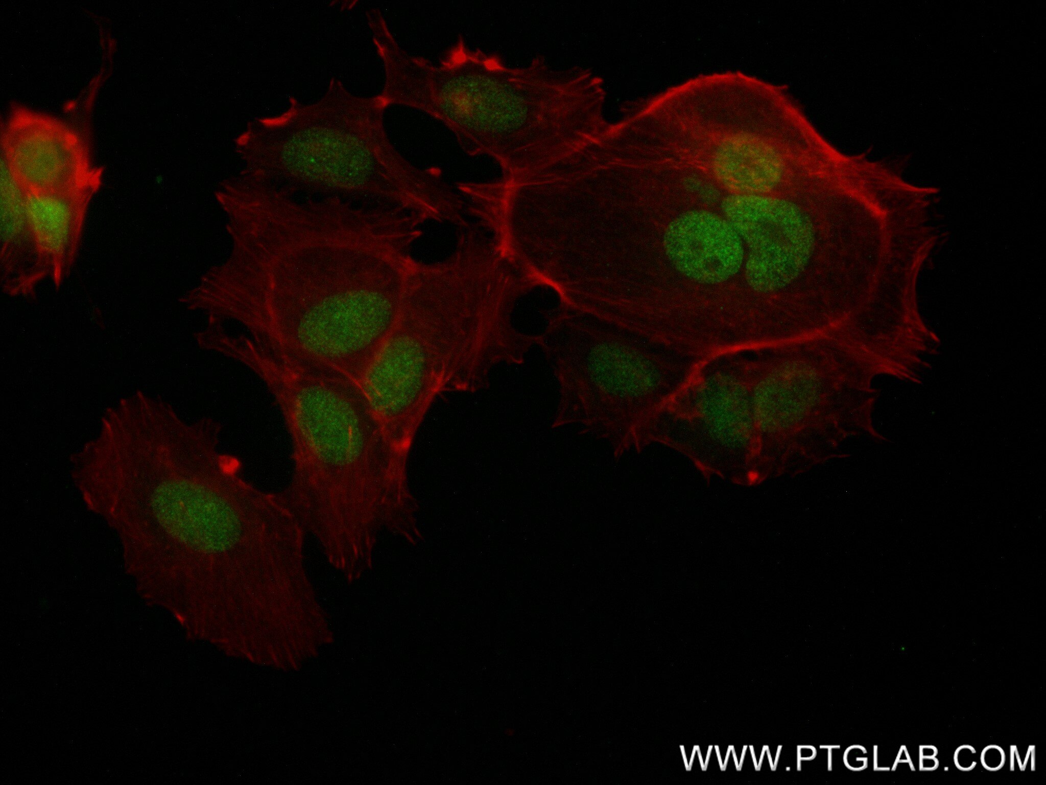 Immunofluorescence (IF) / fluorescent staining of MCF-7 cells using SUZ12 Recombinant antibody (84895-3-RR)