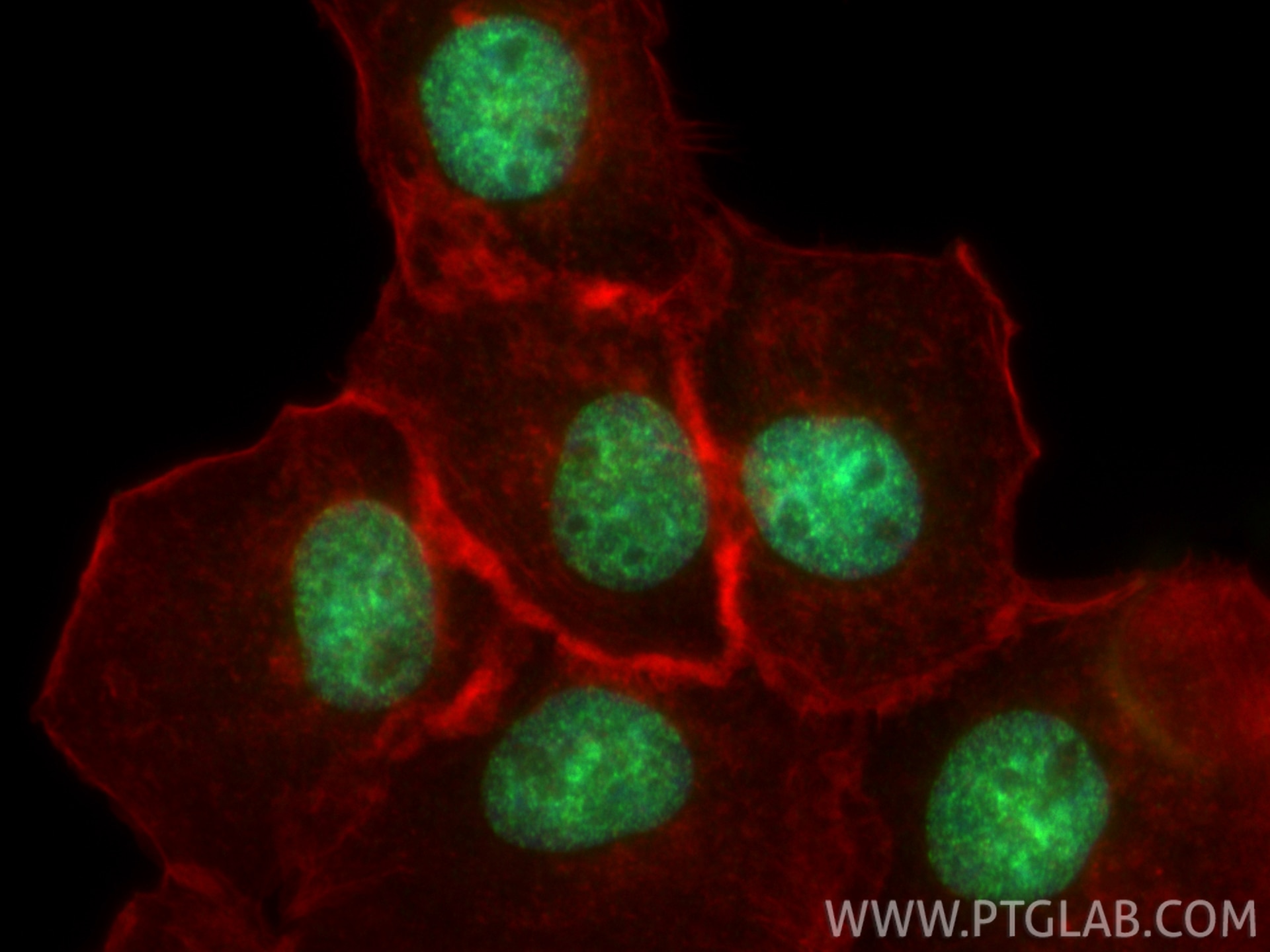 IF Staining of A431 using 84895-3-RR Immunofluorescence (IF) / fluorescent staining of A431 cells using SUZ12 Recombinant monoclonal antibody (84895-3-RR)