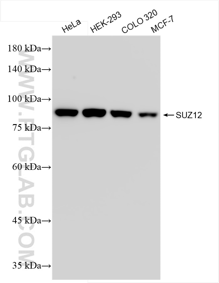 Western Blot (WB) analysis of various lysates using SUZ12 Recombinant antibody (84895-3-RR)