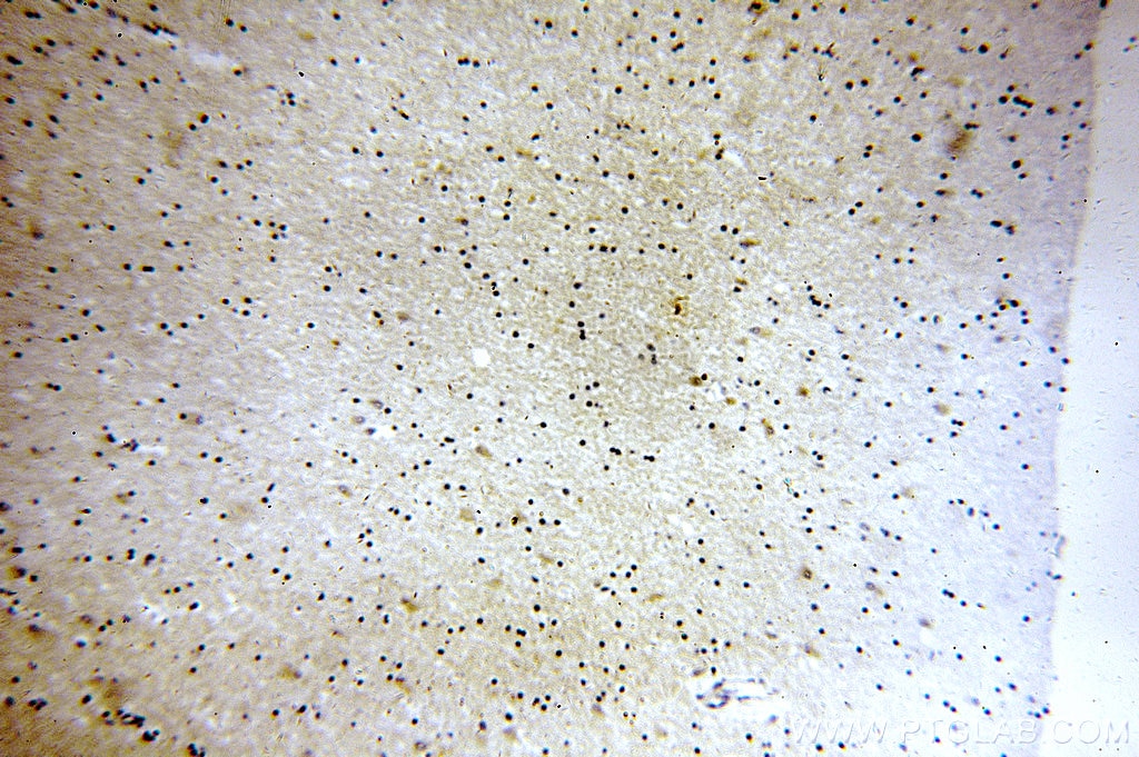 Immunohistochemistry (IHC) staining of human brain tissue using SV2B Polyclonal antibody (14624-1-AP)