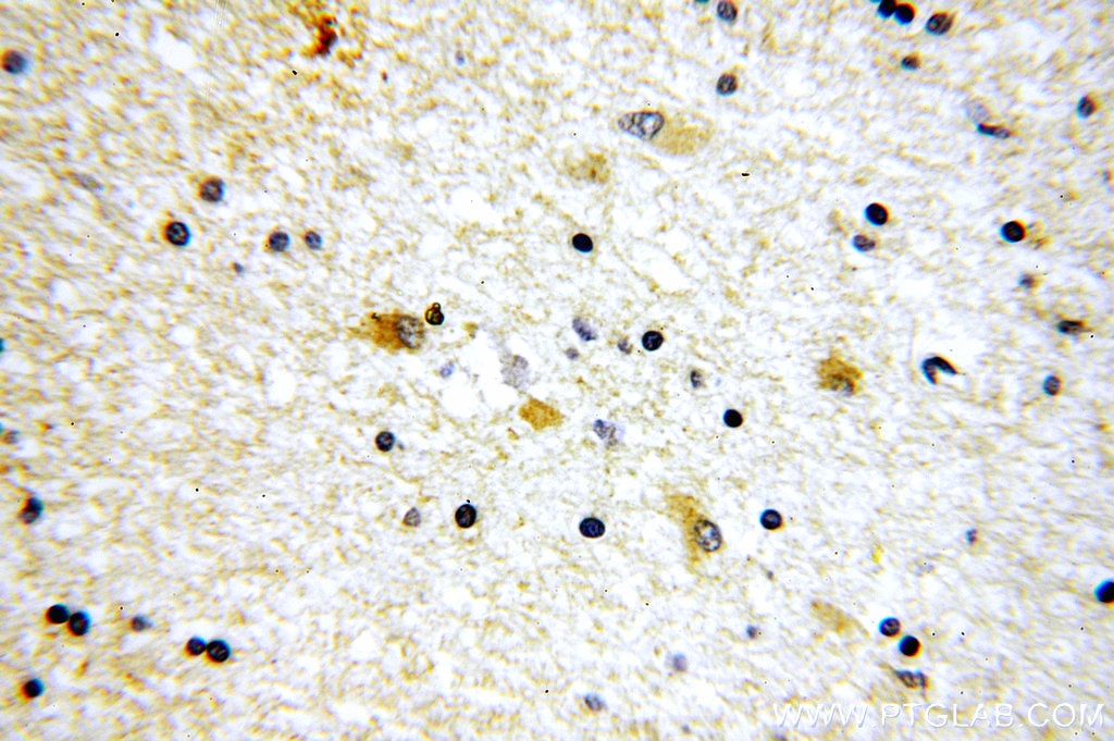 Immunohistochemistry (IHC) staining of human brain tissue using SV2B Polyclonal antibody (14624-1-AP)