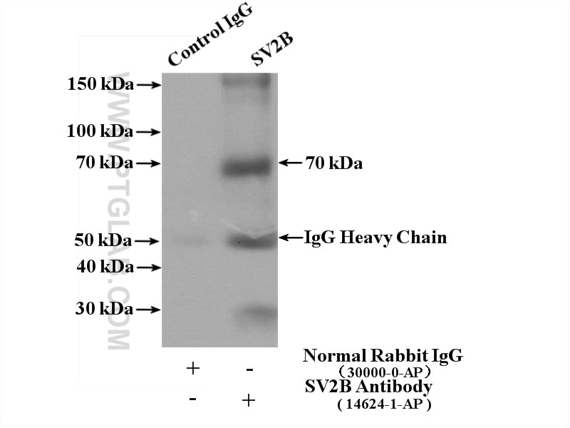 Immunoprecipitation (IP) experiment of mouse brain tissue using SV2B Polyclonal antibody (14624-1-AP)