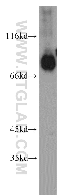 Western Blot (WB) analysis of human brain tissue using SV2B Polyclonal antibody (14624-1-AP)