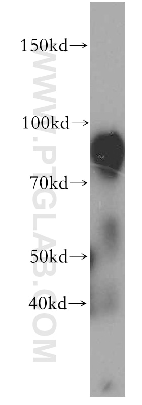 Western Blot (WB) analysis of human brain tissue using SV2B Polyclonal antibody (14624-1-AP)