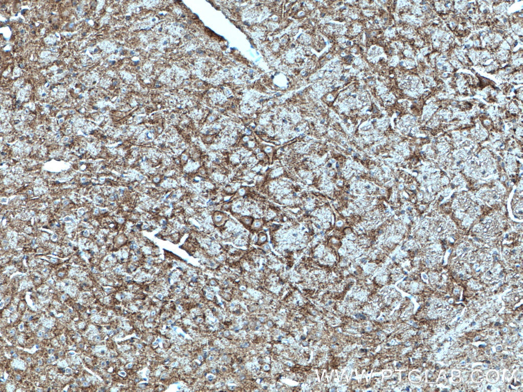 IHC staining of mouse cerebellum using 21271-1-AP