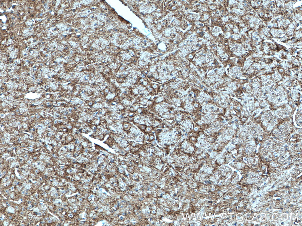 Immunohistochemistry (IHC) staining of mouse cerebellum tissue using SV2C Polyclonal antibody (21271-1-AP)