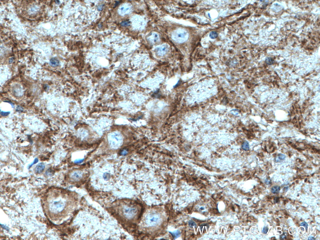 Immunohistochemistry (IHC) staining of mouse cerebellum tissue using SV2C Polyclonal antibody (21271-1-AP)