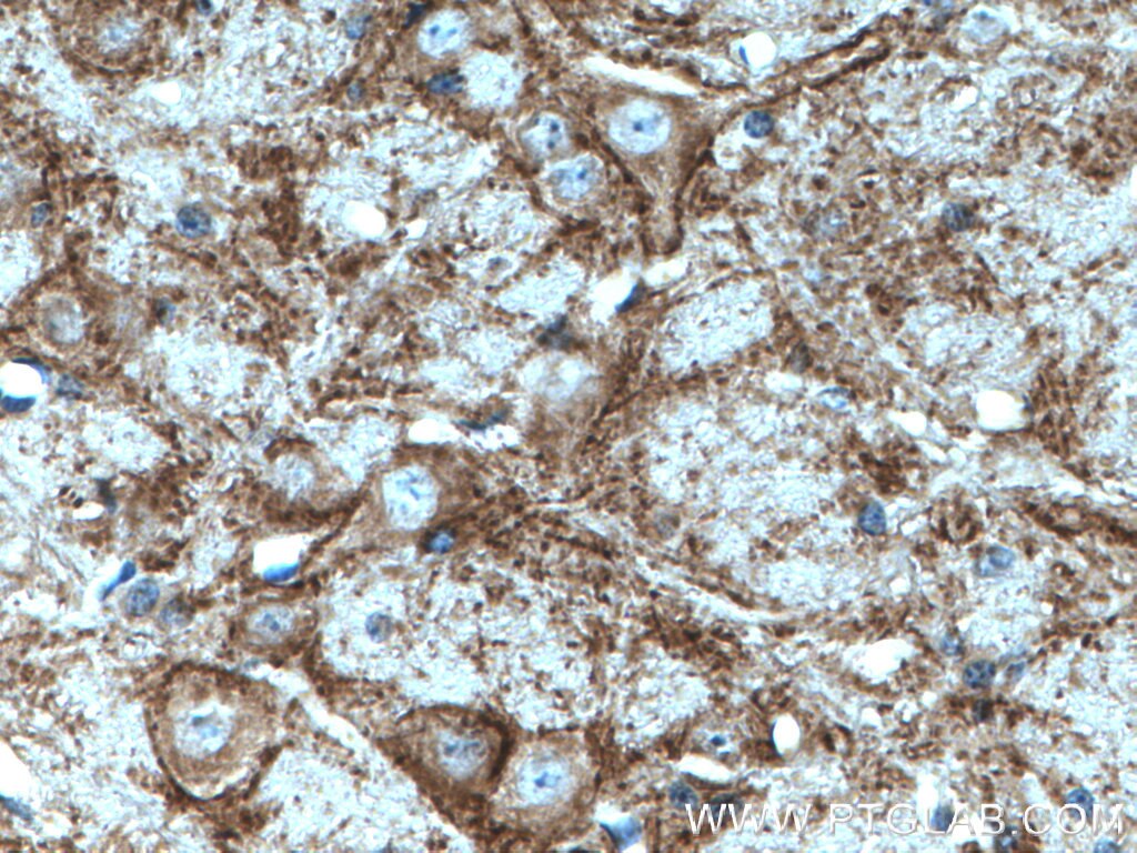 IHC staining of mouse cerebellum using 21271-1-AP