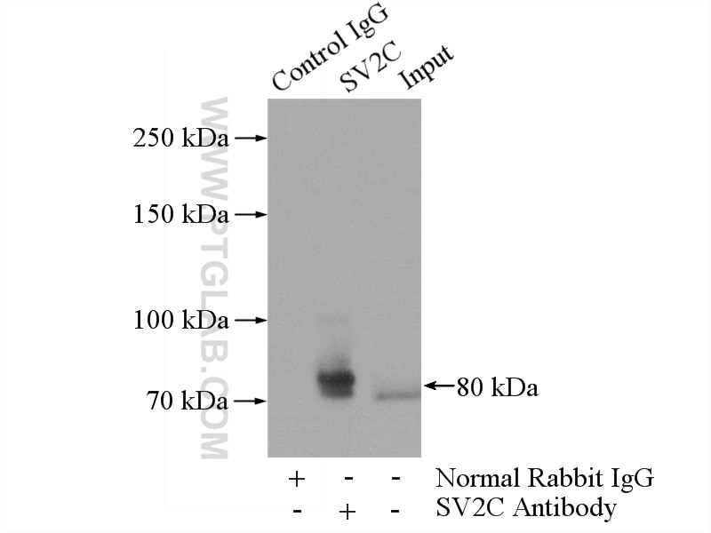 Immunoprecipitation (IP) experiment of mouse brain tissue using SV2C Polyclonal antibody (21271-1-AP)