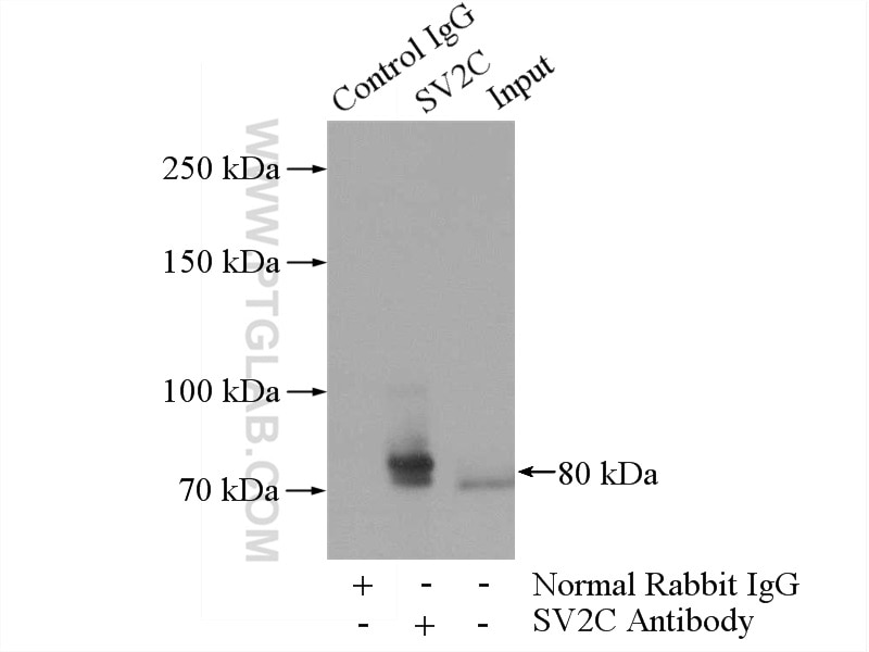 IP experiment of mouse brain using 21271-1-AP