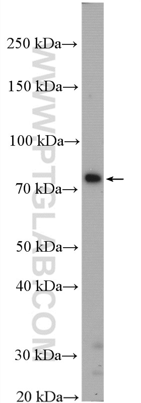 Western Blot (WB) analysis of C6 cells using SV2C Polyclonal antibody (21271-1-AP)