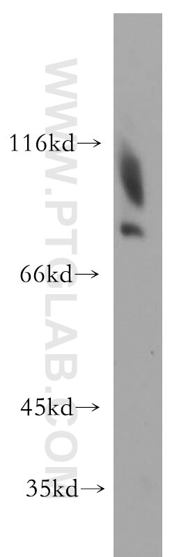 Western Blot (WB) analysis of mouse skin tissue using SV2C Polyclonal antibody (21271-1-AP)