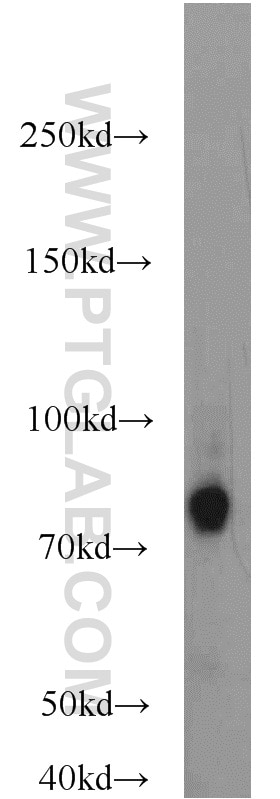 Western Blot (WB) analysis of mouse brain tissue using SV2C Polyclonal antibody (21271-1-AP)