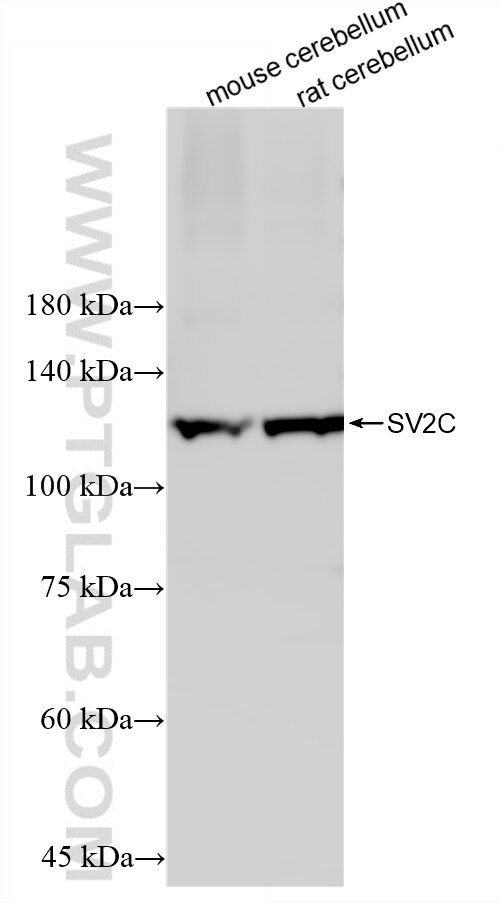 WB analysis using 88136-1-RR Western Blot (WB) analysis of various lysates using SV2C Recombinant monoclonal antibody (88136-1-RR)