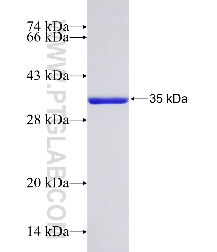 SV2C fusion protein Ag32318 SDS-PAGE SV2C fusion protein Ag32318 SDS-PAGE