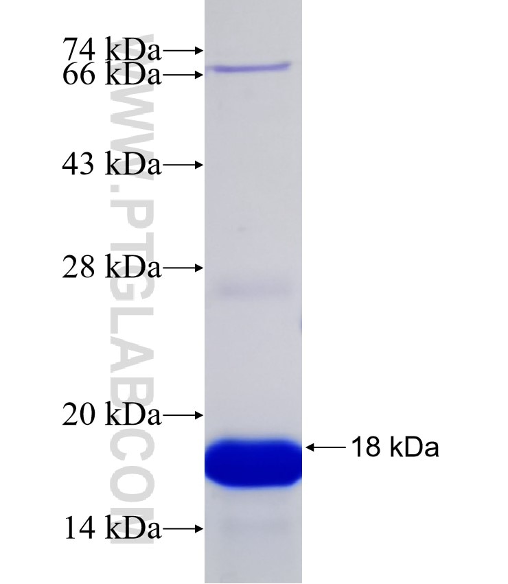 SV2C fusion protein Ag32332 SDS-PAGE SV2C fusion protein Ag32332 SDS-PAGE
