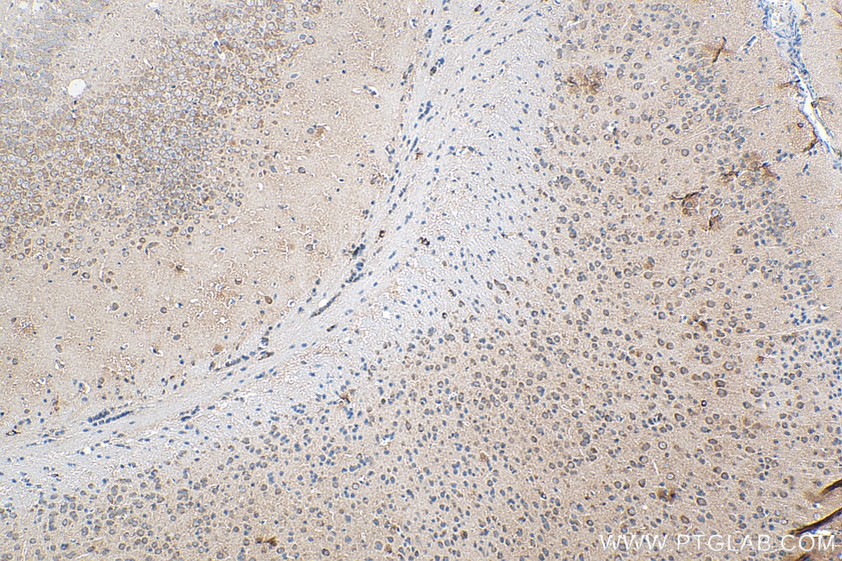 Immunohistochemistry (IHC) staining of mouse brain tissue using SVCT2 Polyclonal antibody (27019-1-AP)