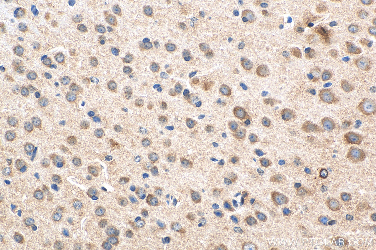 IHC staining of mouse brain using 27019-1-AP