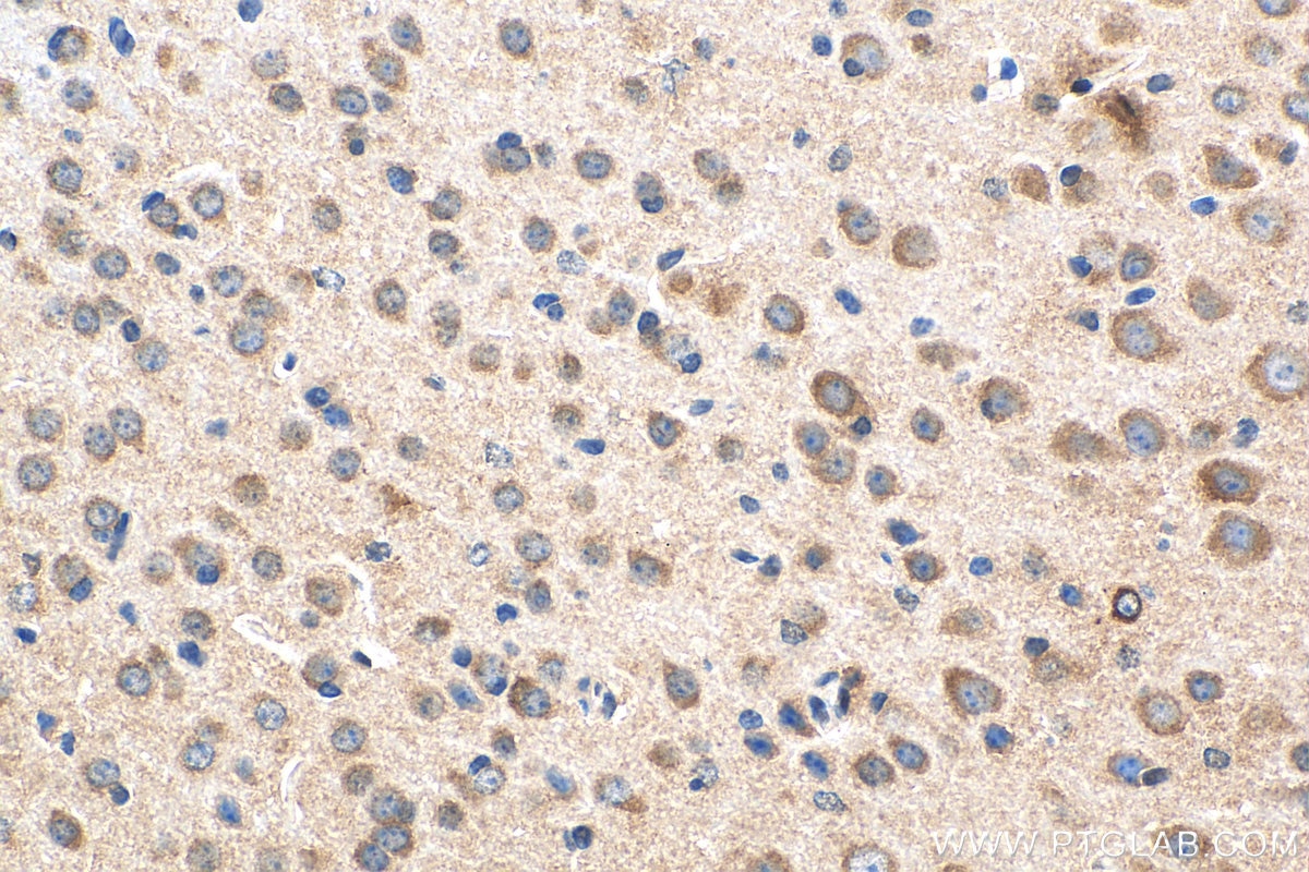 Immunohistochemistry (IHC) staining of mouse brain tissue using SVCT2 Polyclonal antibody (27019-1-AP)