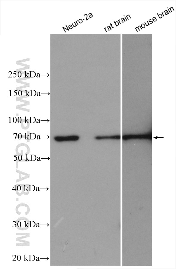 Western Blot (WB) analysis of various lysates using SVCT2 Polyclonal antibody (27019-1-AP)