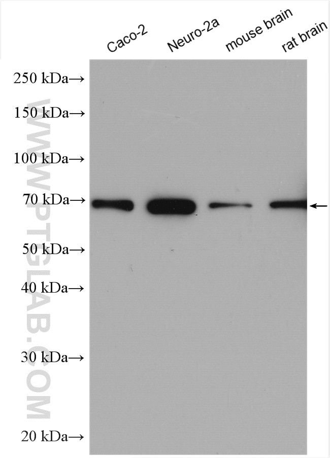 Western Blot (WB) analysis of various lysates using SVCT2 Polyclonal antibody (27019-1-AP)