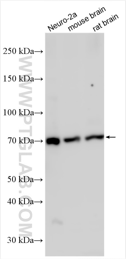 Western Blot (WB) analysis of various lysates using SVCT2 Polyclonal antibody (27019-1-AP)