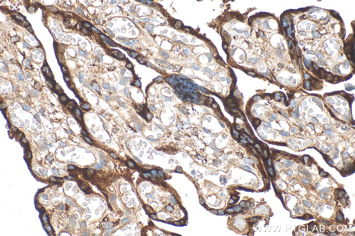 Immunohistochemical analysis of paraffin-embedded human placenta tissue slide using 31030-1-AP (SVEP1 antibody) at dilution of 1:1000 (under 40x lens). Heat mediated antigen retrieval with Tris-EDTA buffer (pH 9.0). Immunohistochemistry (IHC) staining of human placenta tissue using SVEP1 Polyclonal antibody (31030-1-AP)