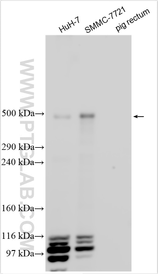 Western Blot (WB) analysis of various lysates using SVEP1 Polyclonal antibody (31030-1-AP)