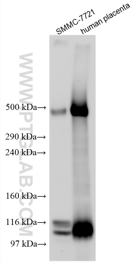 Various lysates were subjected to Tris-Acetate gel system followed by western blot with 31030-1-AP (SVEP1 antibody) at dilution of 1:600 incubated at room temperature for 1.5 hours. Western Blot (WB) analysis of various lysates using SVEP1 Polyclonal antibody (31030-1-AP)