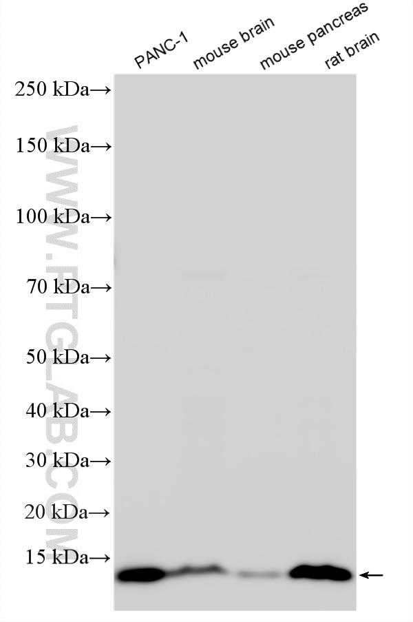 WB analysis using 32511-1-AP (same clone as 32511-1-PBS) Western Blot (WB) analysis of various lysates using SVIP Polyclonal antibody (32511-1-AP)