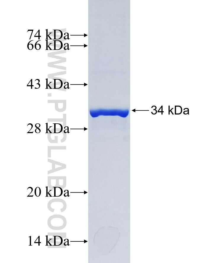 SVIP fusion protein Ag36618 SDS-PAGE