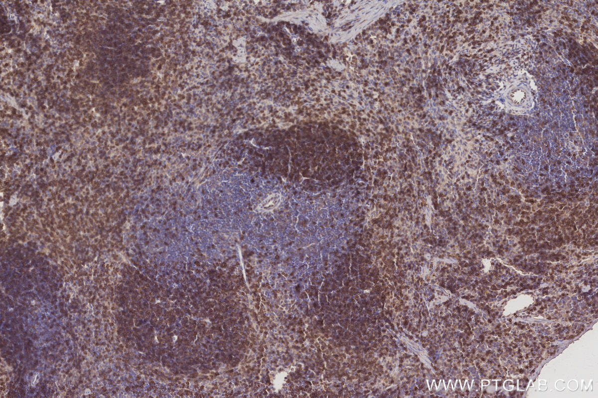 Immunohistochemistry (IHC) staining of mouse spleen tissue using SWAP70 Polyclonal antibody (31042-1-AP)