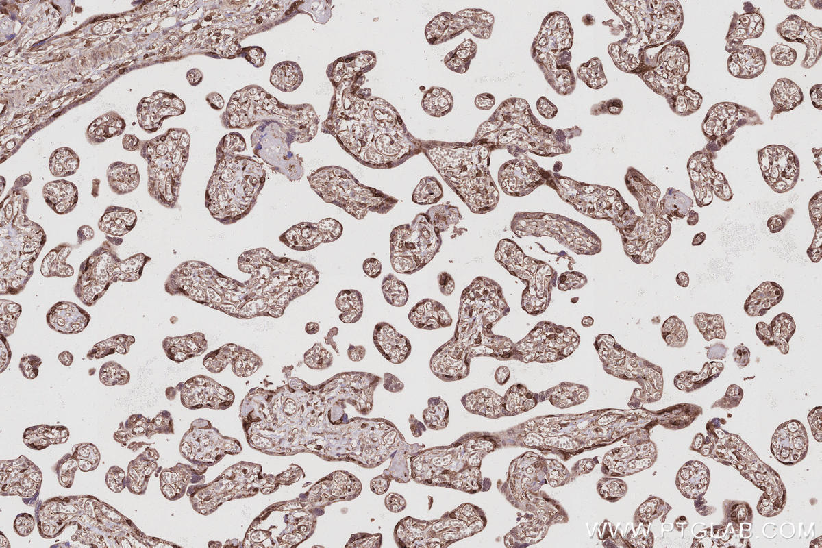 Immunohistochemistry (IHC) staining of human placenta tissue using SWAP70 Polyclonal antibody (31042-1-AP)
