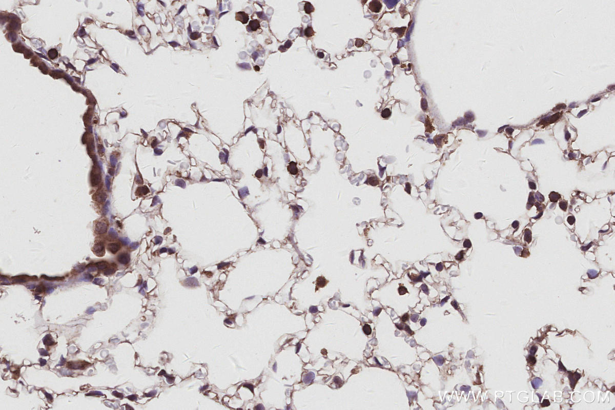 Immunohistochemistry (IHC) staining of mouse lung tissue using SWAP70 Polyclonal antibody (31042-1-AP)