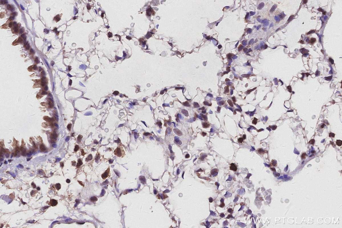 Immunohistochemistry (IHC) staining of rat lung tissue using SWAP70 Polyclonal antibody (31042-1-AP)