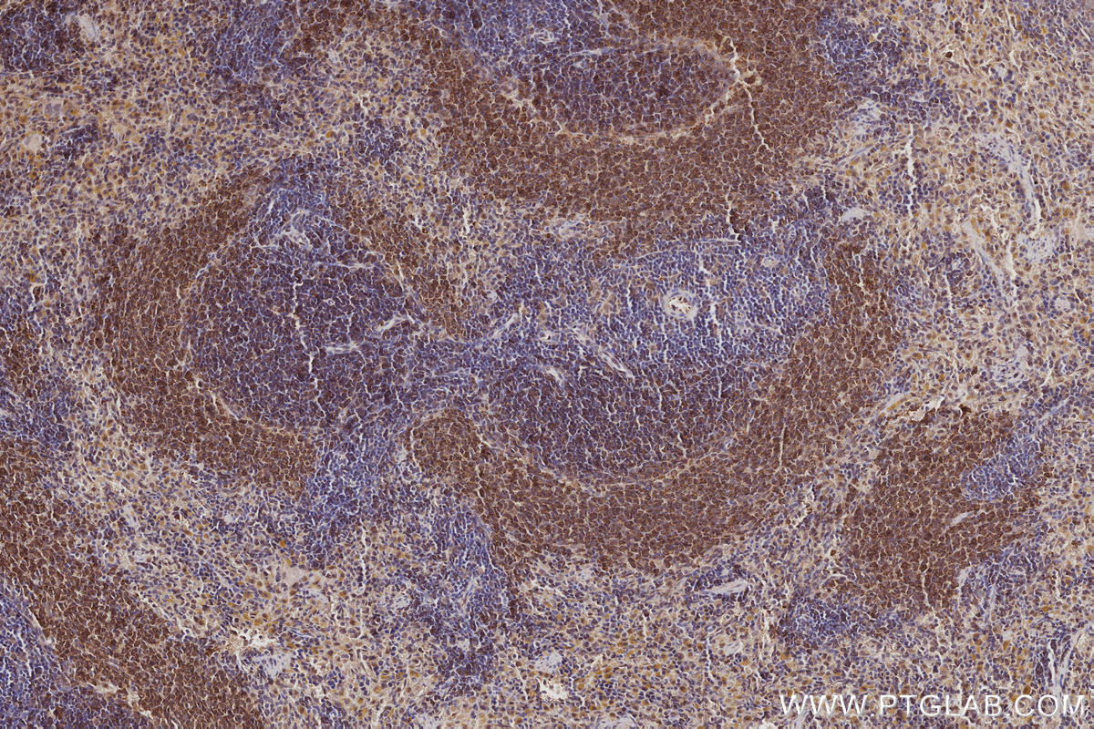 Immunohistochemistry (IHC) staining of rat spleen tissue using SWAP70 Polyclonal antibody (31042-1-AP)