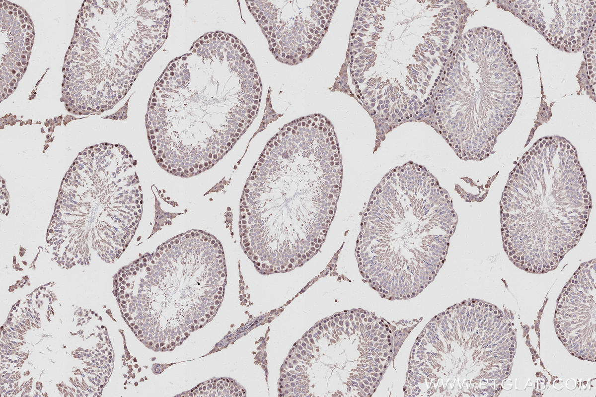 Immunohistochemistry (IHC) staining of rat testis tissue using SWAP70 Polyclonal antibody (31042-1-AP)