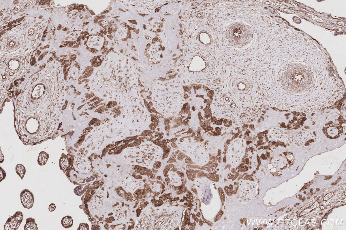Immunohistochemistry (IHC) staining of human placenta tissue using SWAP70 Polyclonal antibody (31042-1-AP)